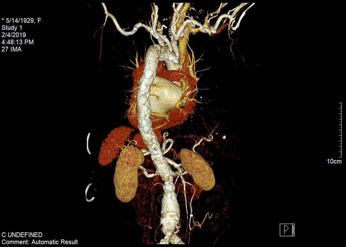 Vascular Imaging - University Diagnostic Medical Imaging